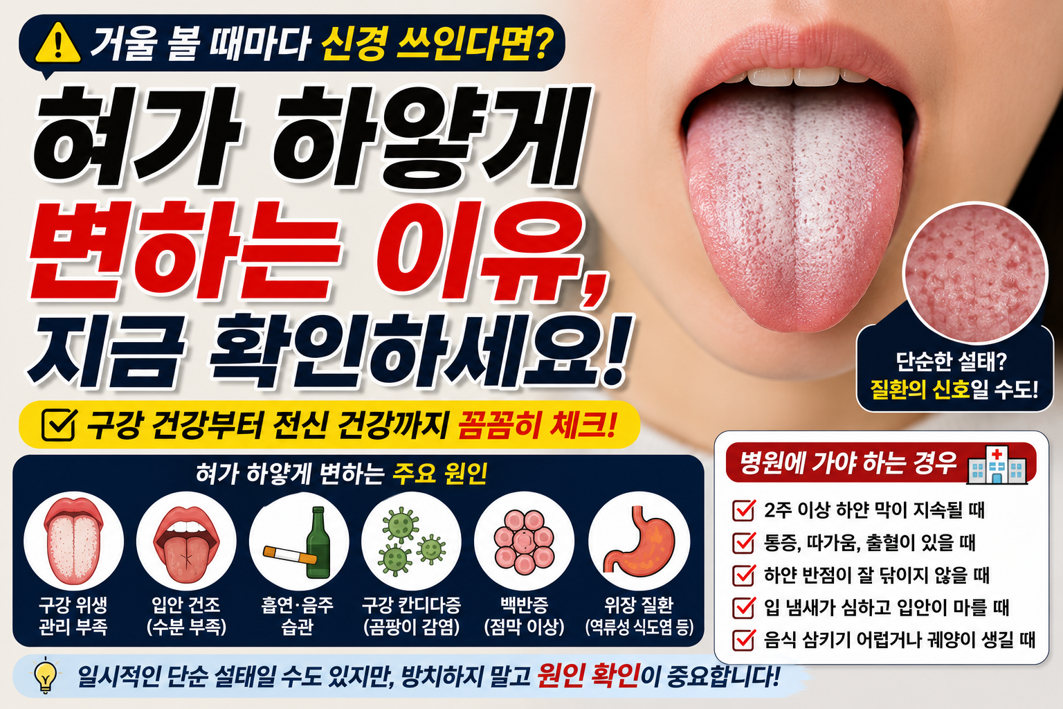 혀가 하얗게 변하는 이유 썸네일