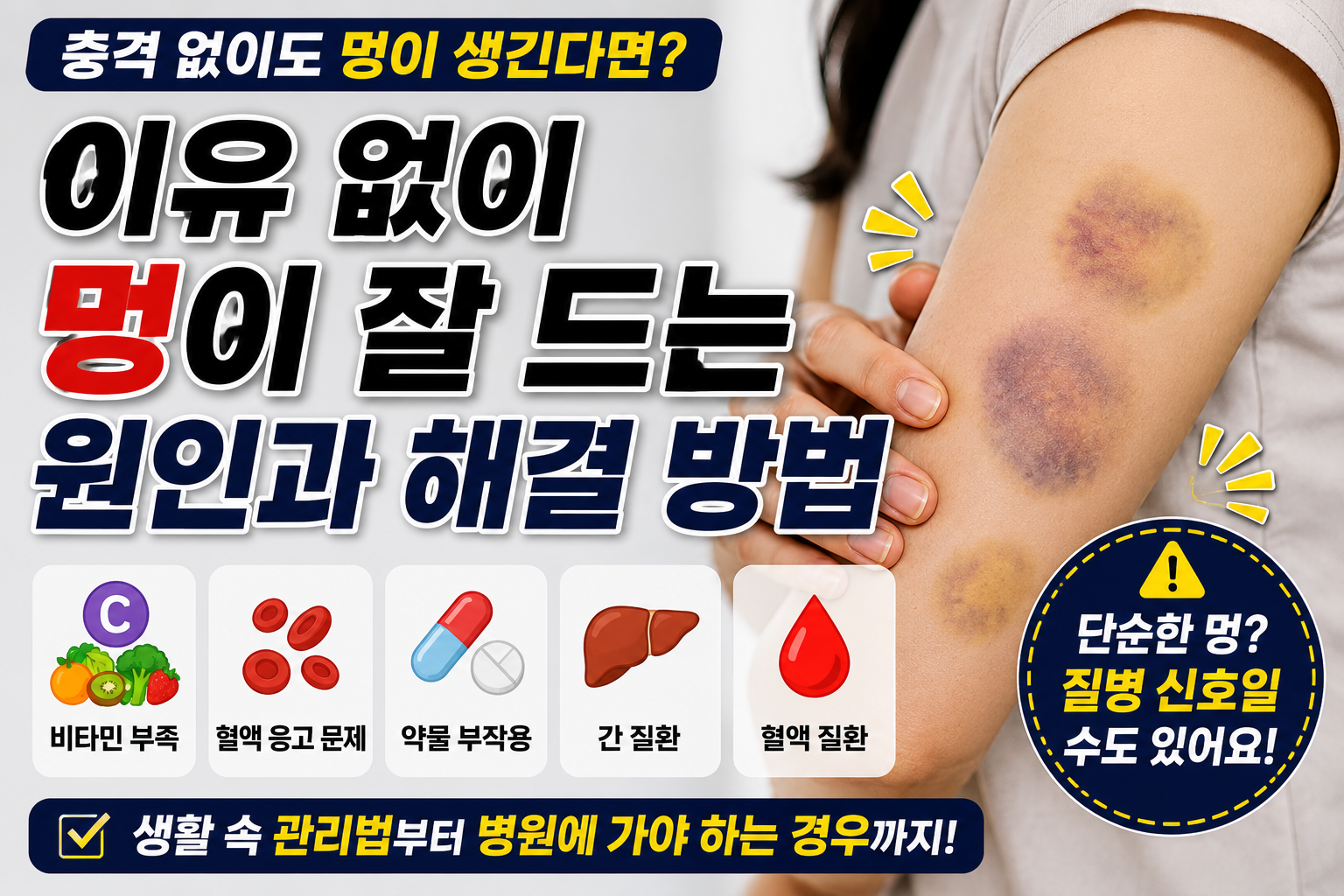 이유없이 멍이 잘 드는 원인 썸네일