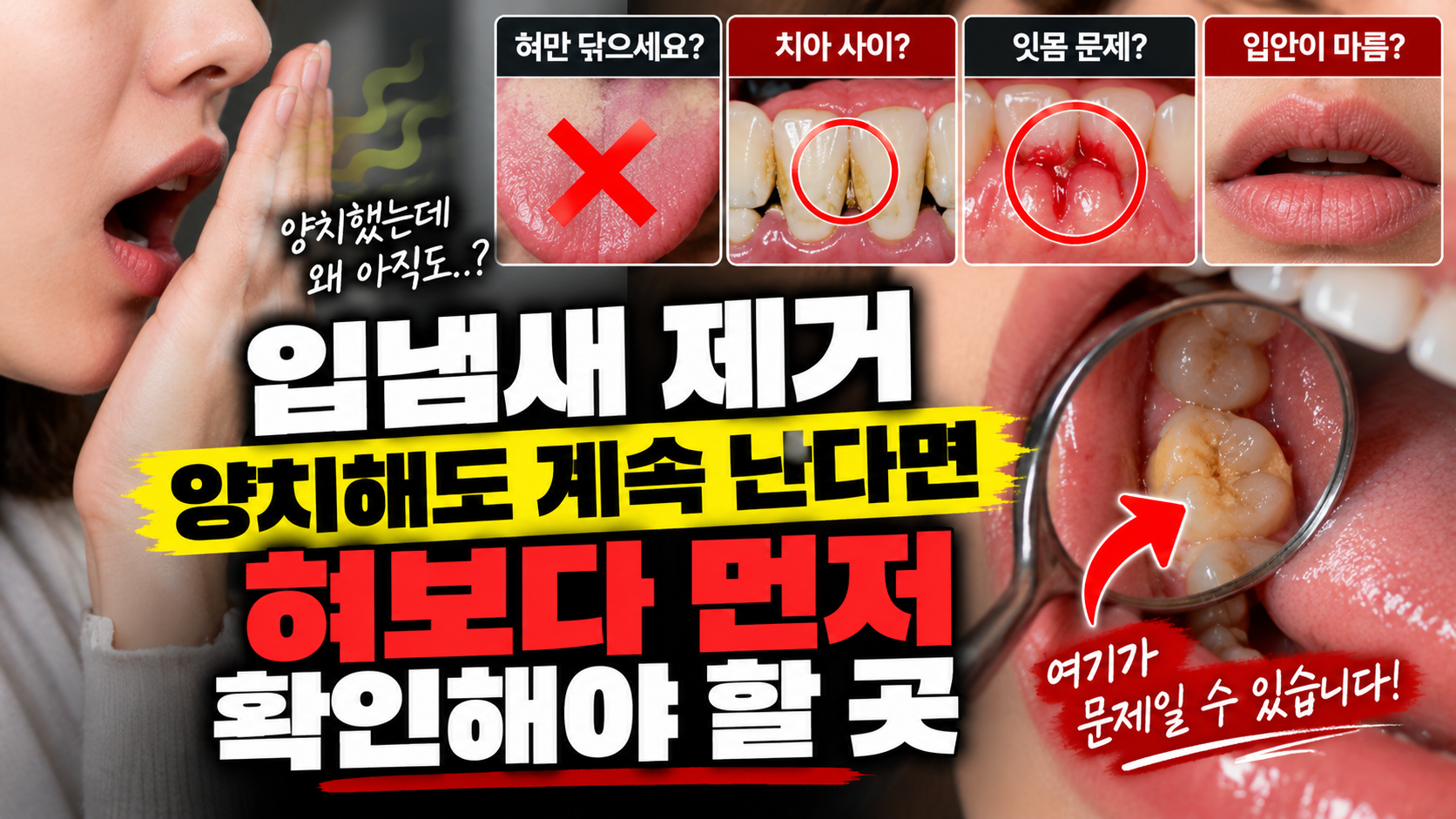 입냄새 제거 양치해도 계속 난다면 썸네일