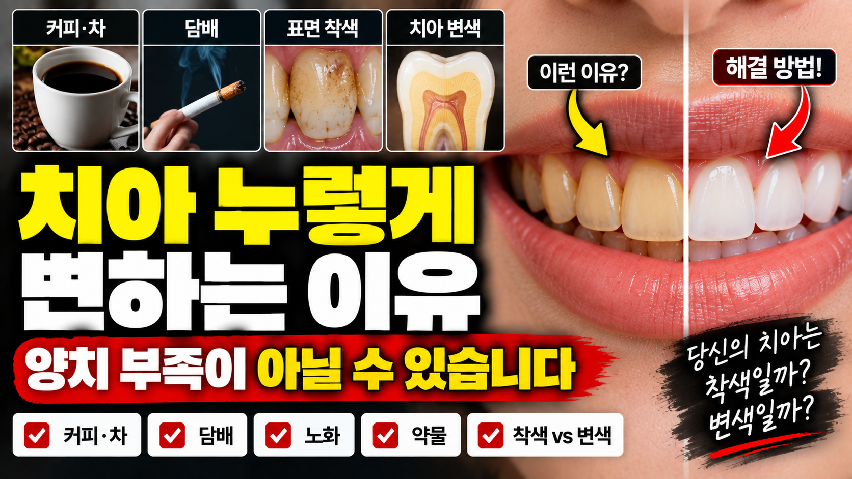 치아 누렇게 변하는 이유 썸네일
