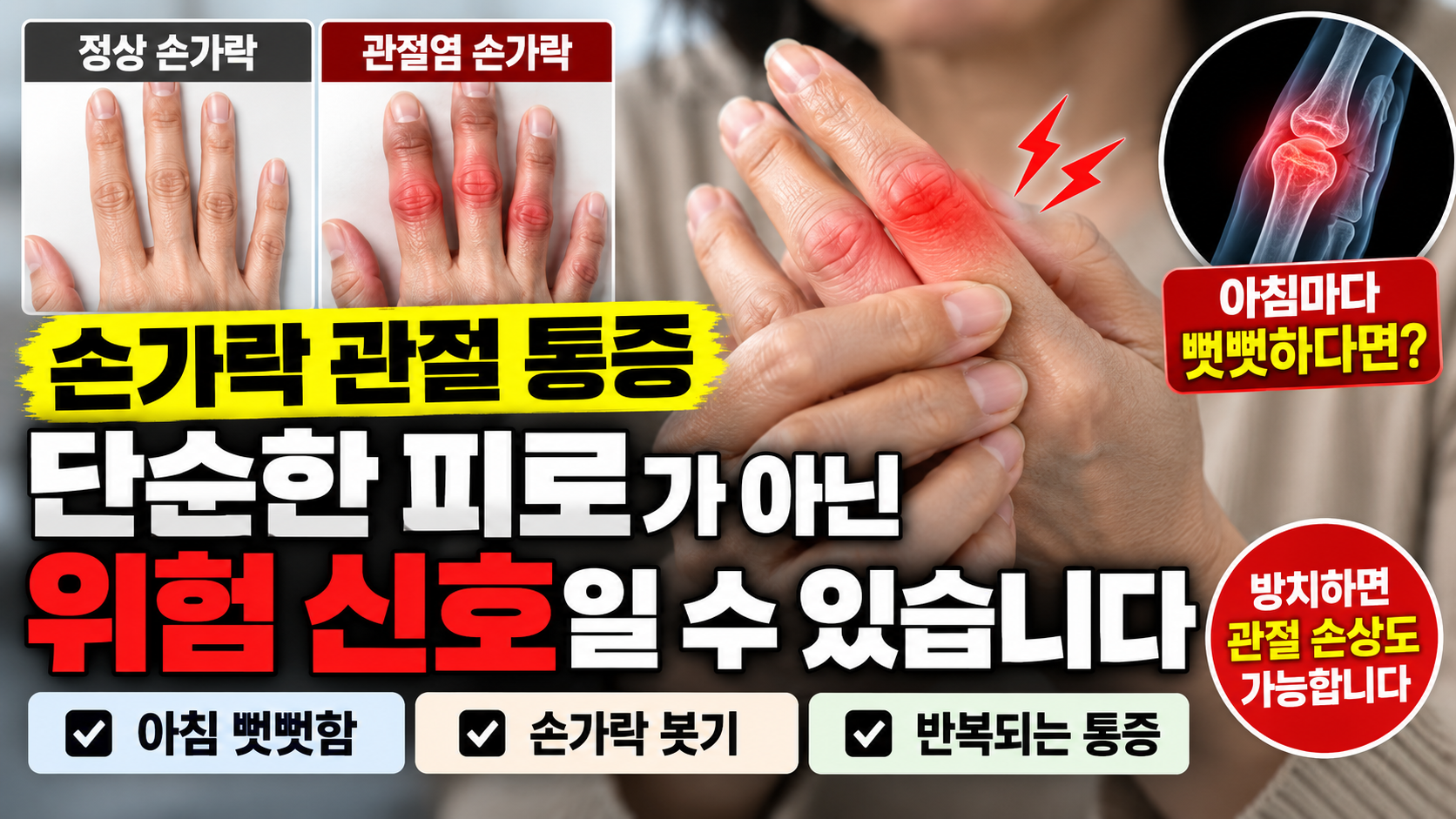 손가락 관절 통증 썸네일